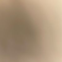 willy_1732050