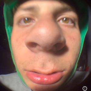its_itch