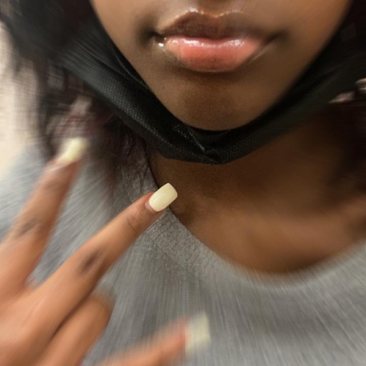 @bracesface_laya