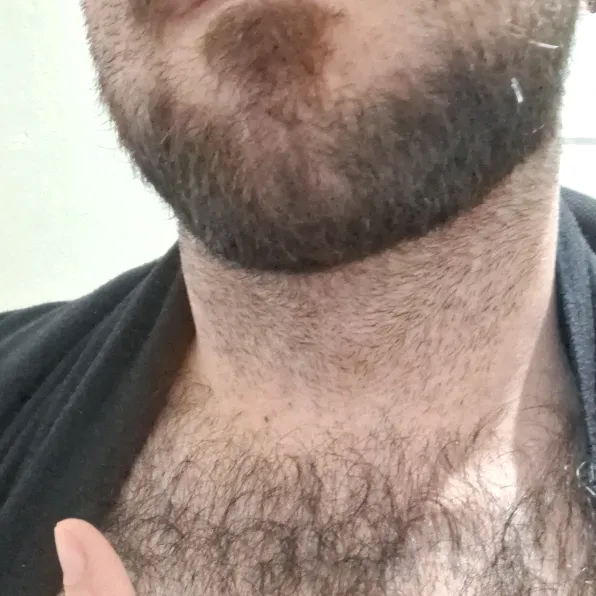 raphadebarba