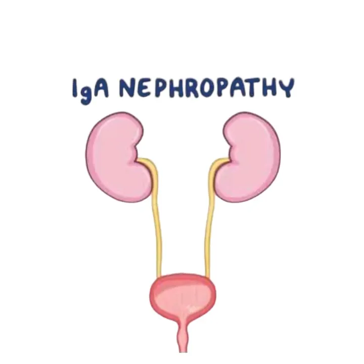 @iganephropathyph